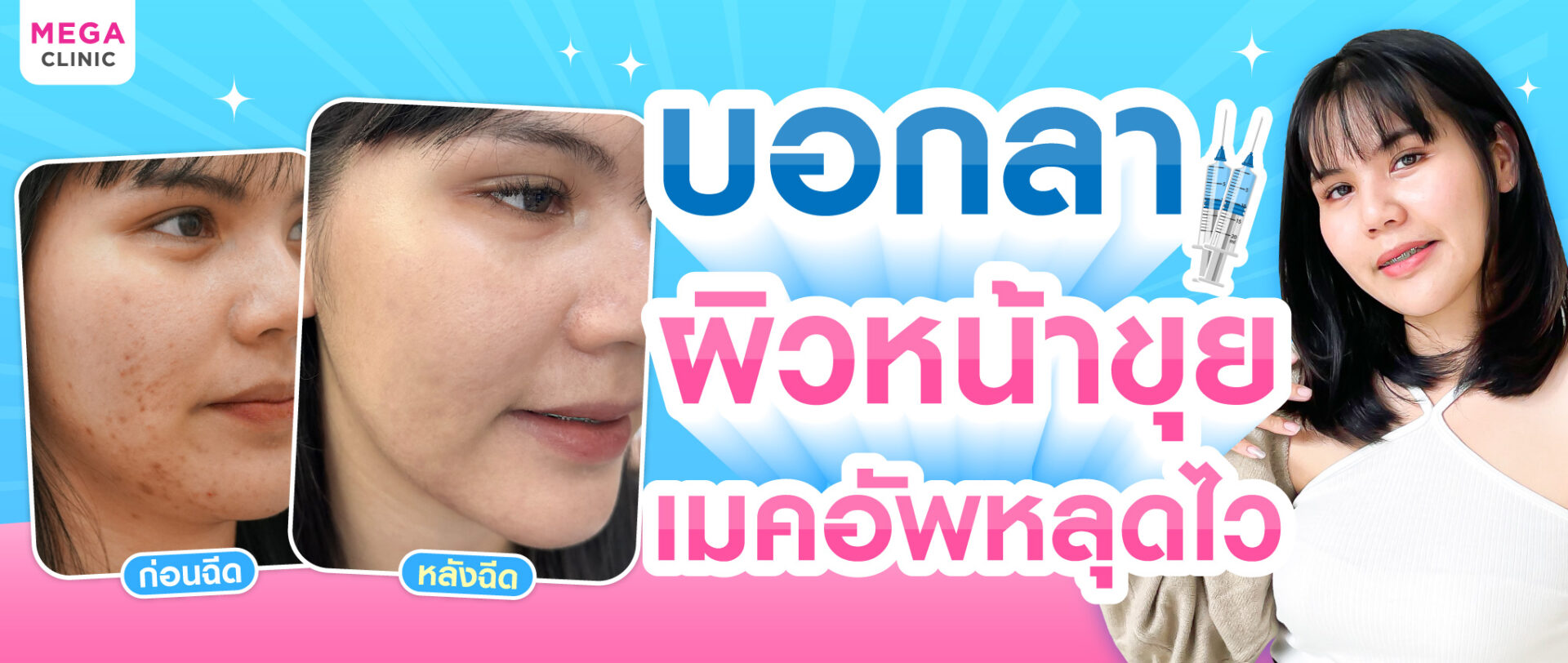 เมคอัพหลุด แก้ได้ด้วย ฉีดหน้าใส