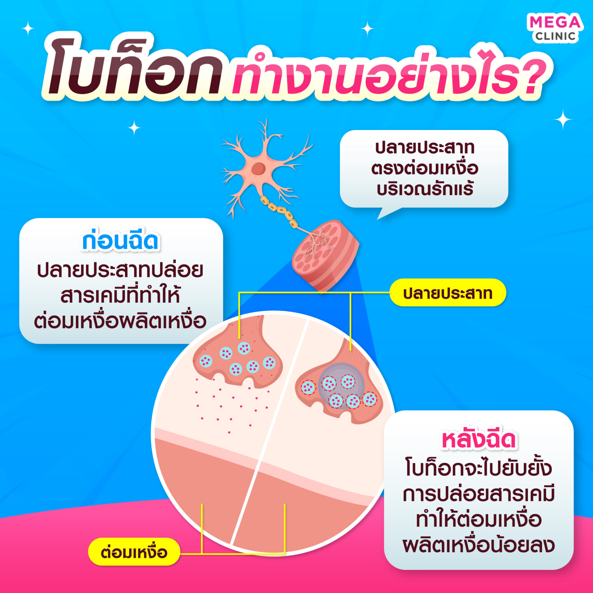 การออกฤทธิ์ของตัวยาโบท็อกที่ต่อมเหงื่อใต้รักแร้