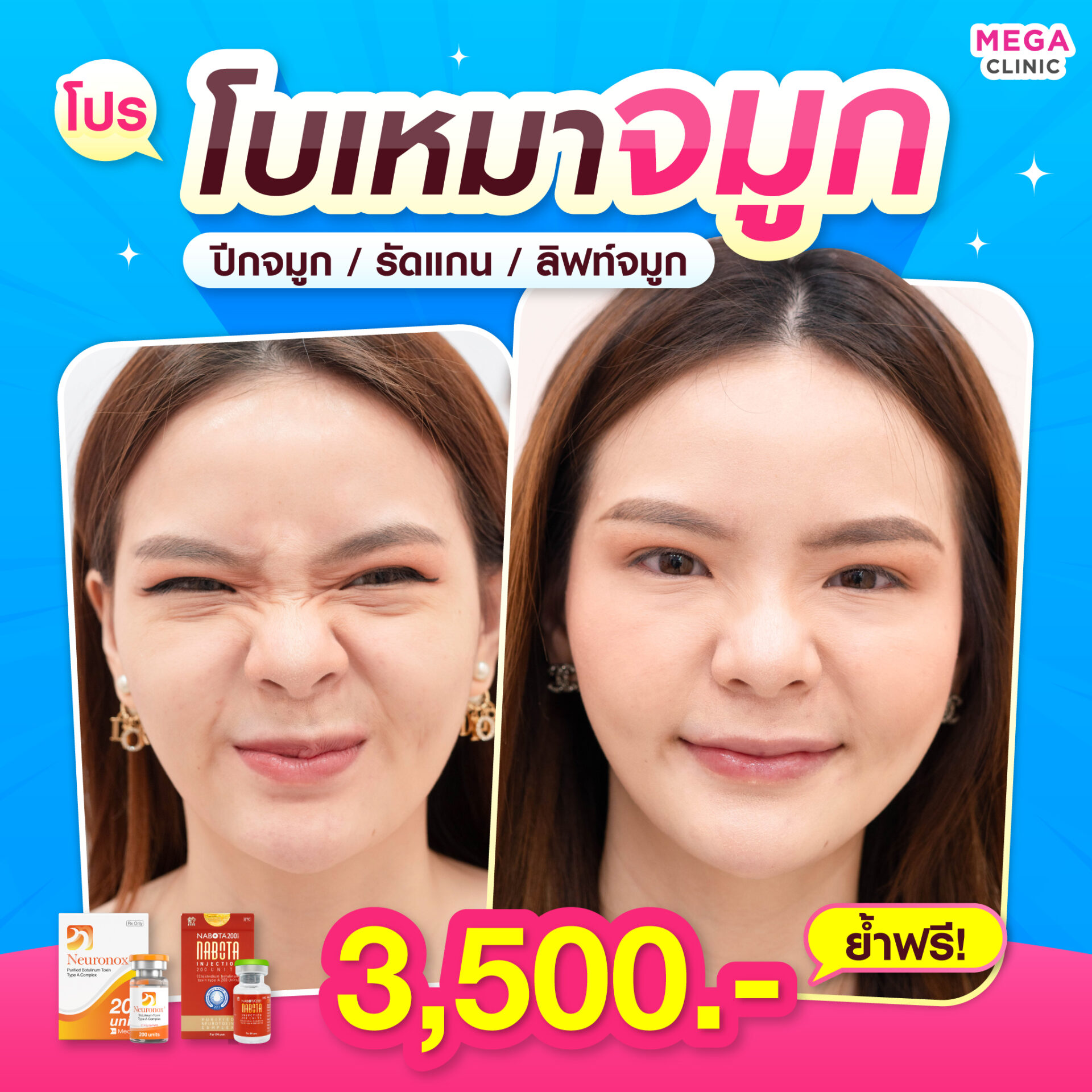 โปรโมชั่น โบท็อกเก็บทรงจมูก