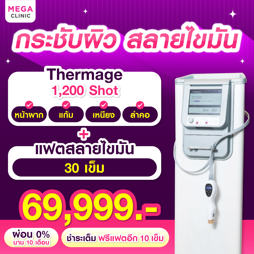 ทำ Thermage ราคาผ่อน 0% 10 เดือน