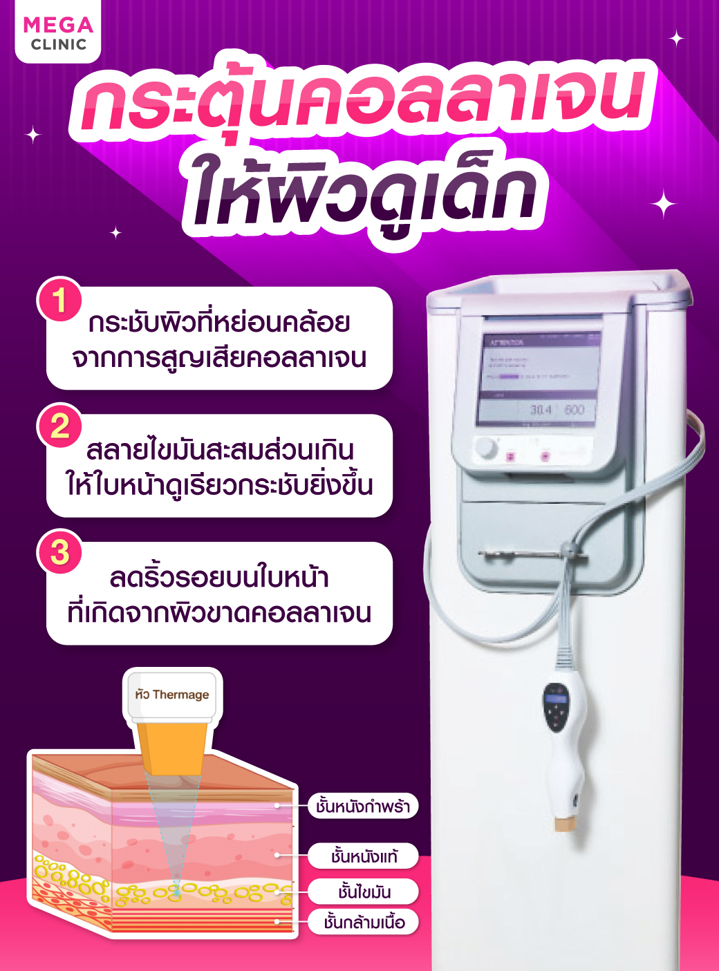 Thermage คืออะไร พร้อมหลักการทำงาน