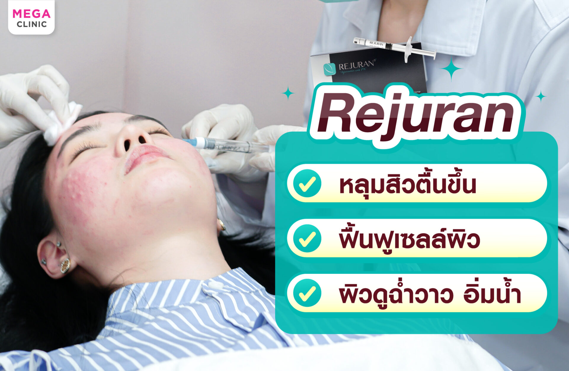 คุณสมบัติ Rejuran ช่วยเรื่องหลุมสิว