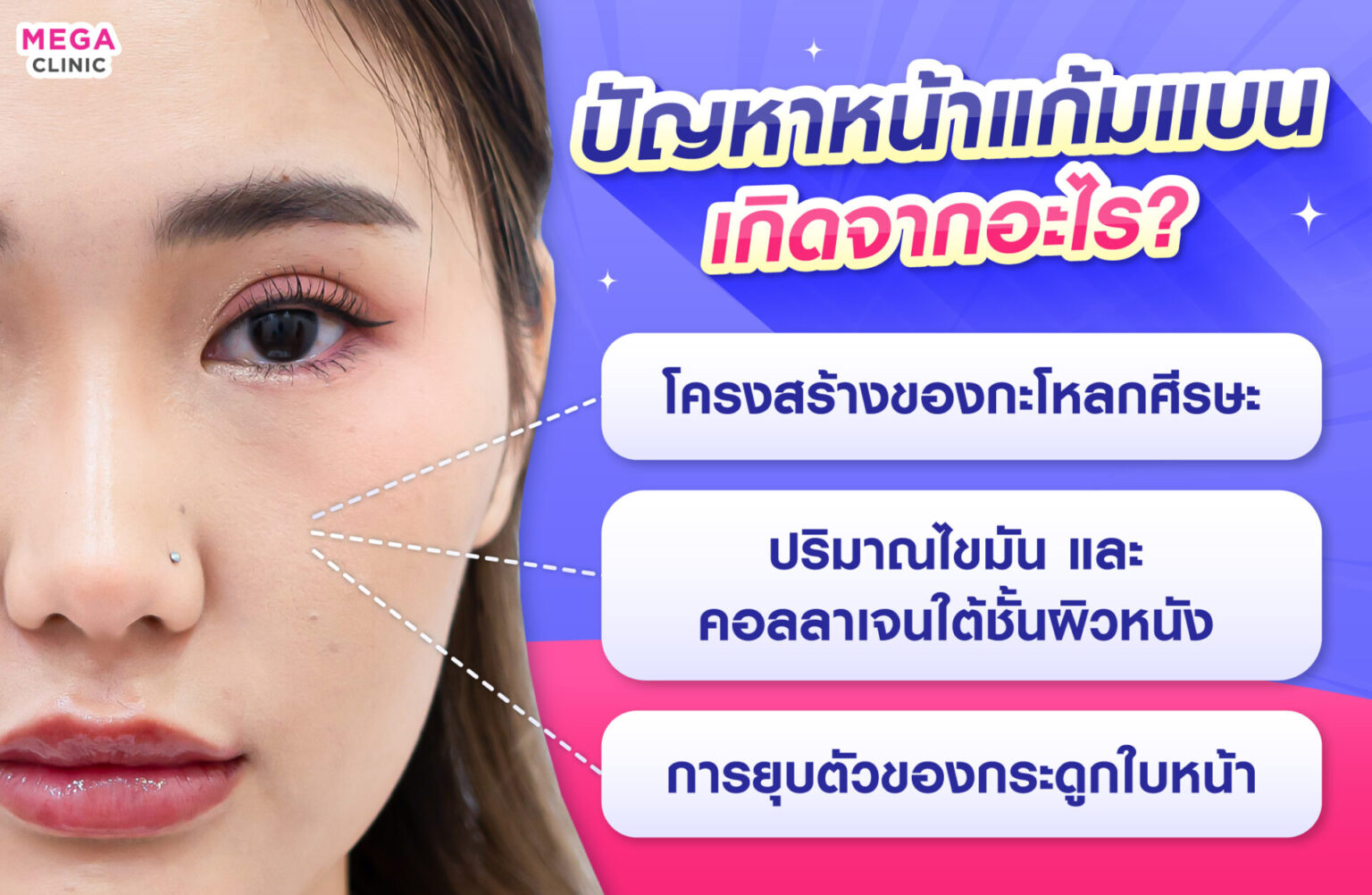 หน้าแก้มแบน เกิดจากอะไร