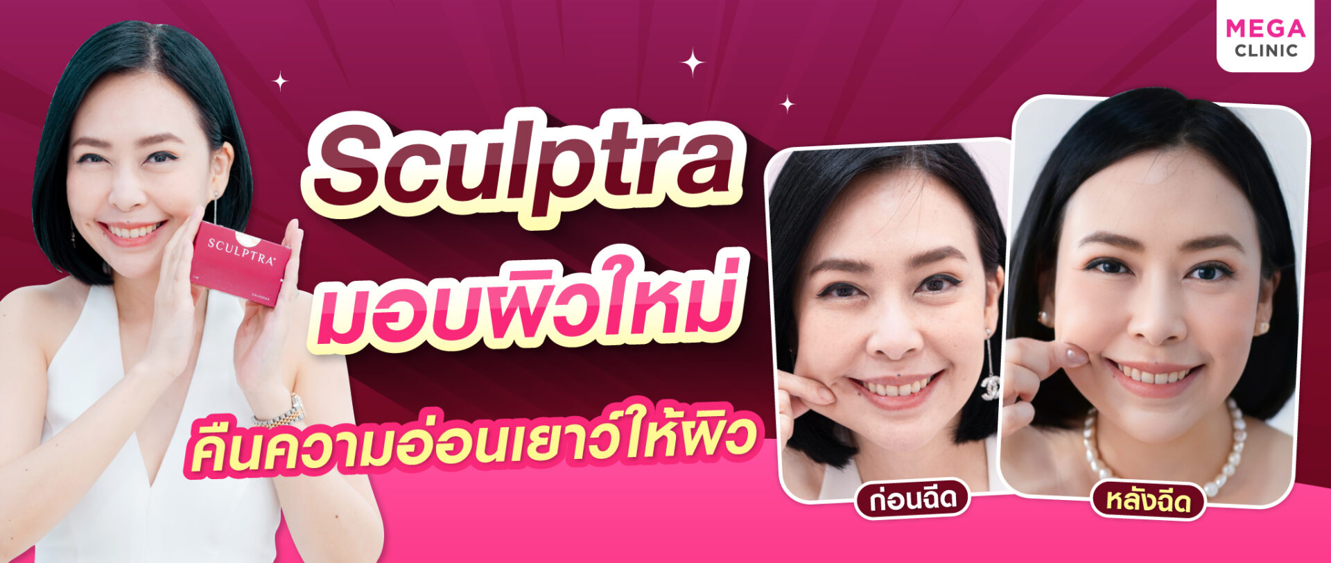 ฉีด Sculptra ผิวแน่นอิ่มฟู