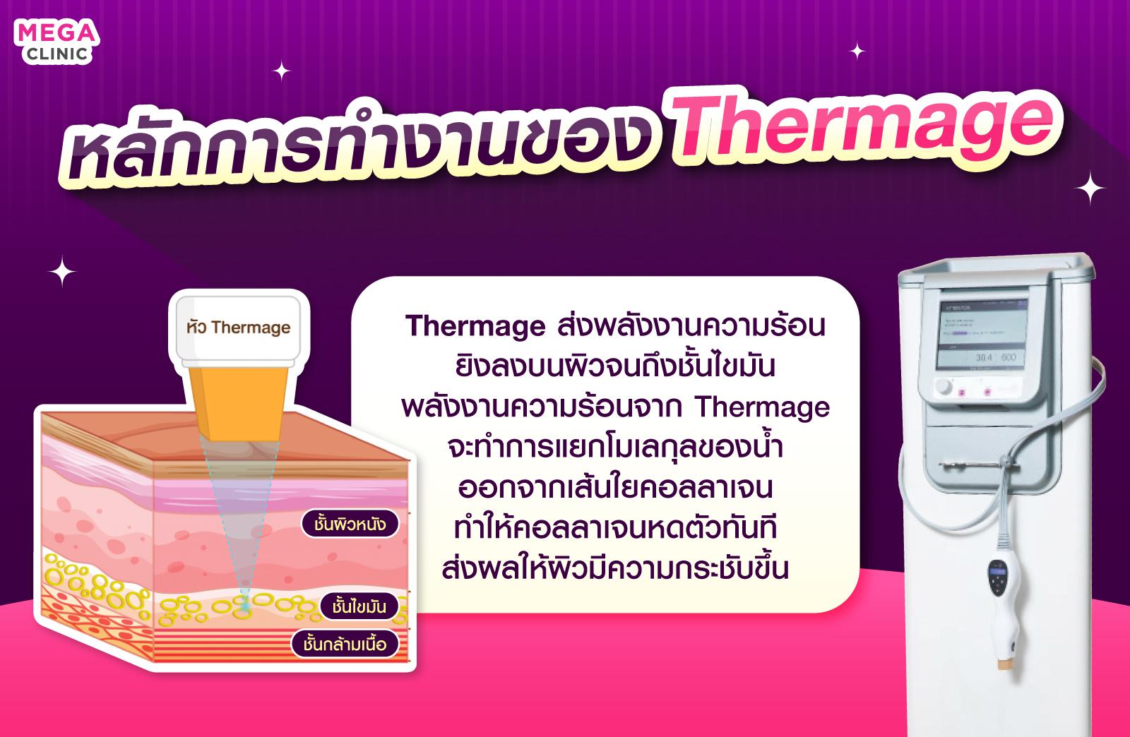 การทำงานของ Thermage