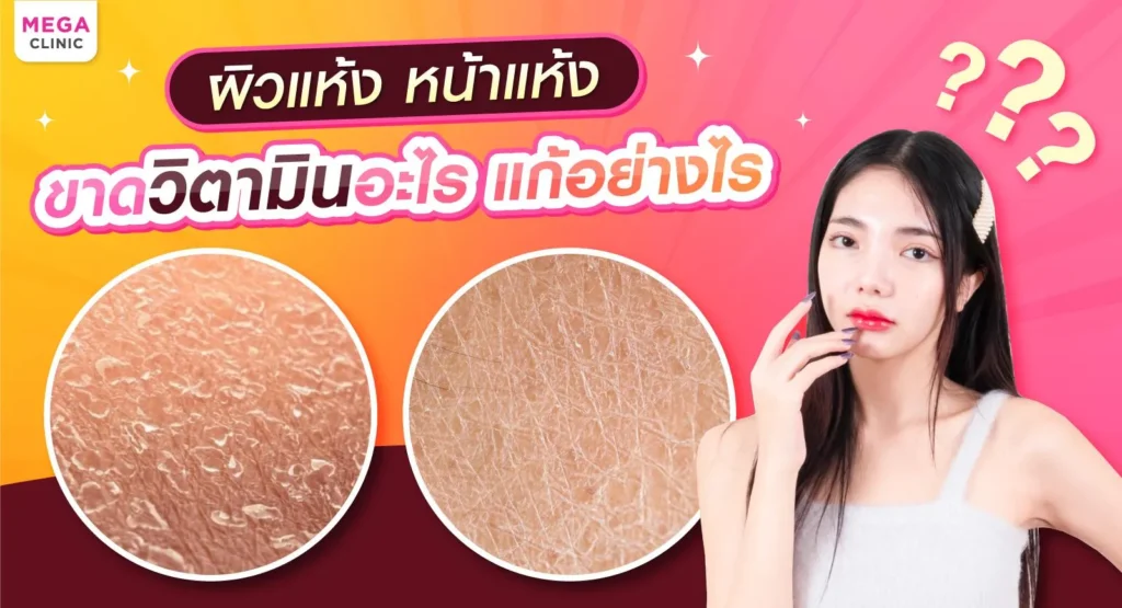 ผิวแห้ง หน้าแห้ง ขาดวิตามินอะไร?
