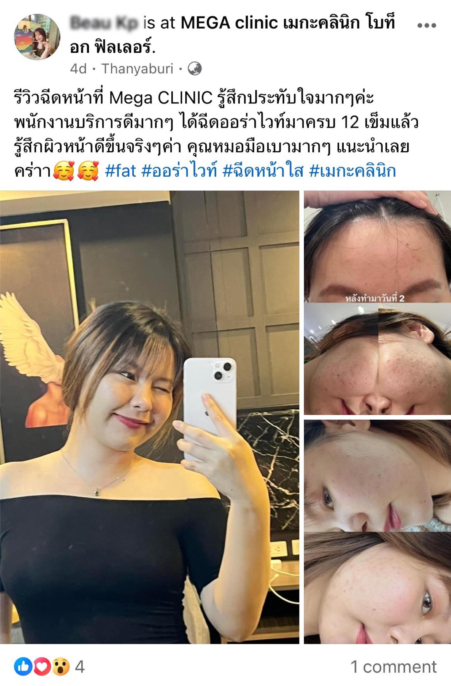 ฉีดออร่าไวท์ต่อเนื่อง รีวิวใน Facebook Group