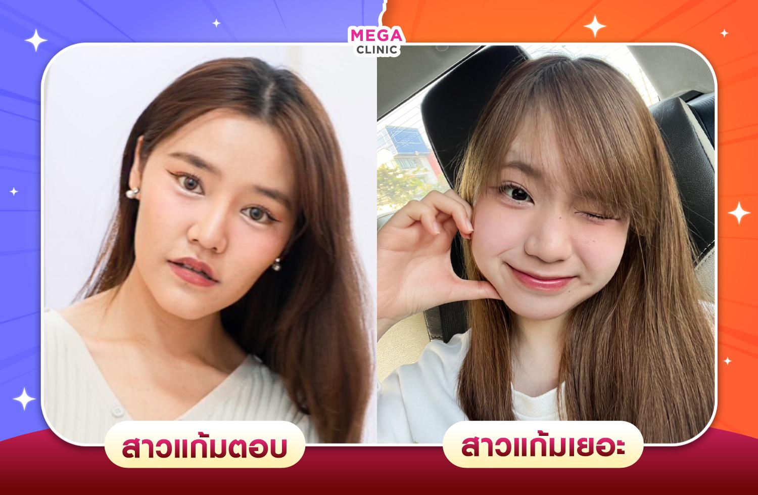 สาวแก้มเยอะ & สาวแก้มตอบ