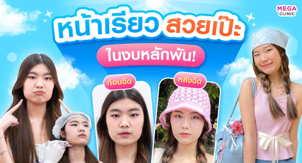 เตรียมพร้อมสำหรับวันสำคัญ ฉีดหน้าเรียว ให้สวยเป๊ะ ในงบหลักพัน!