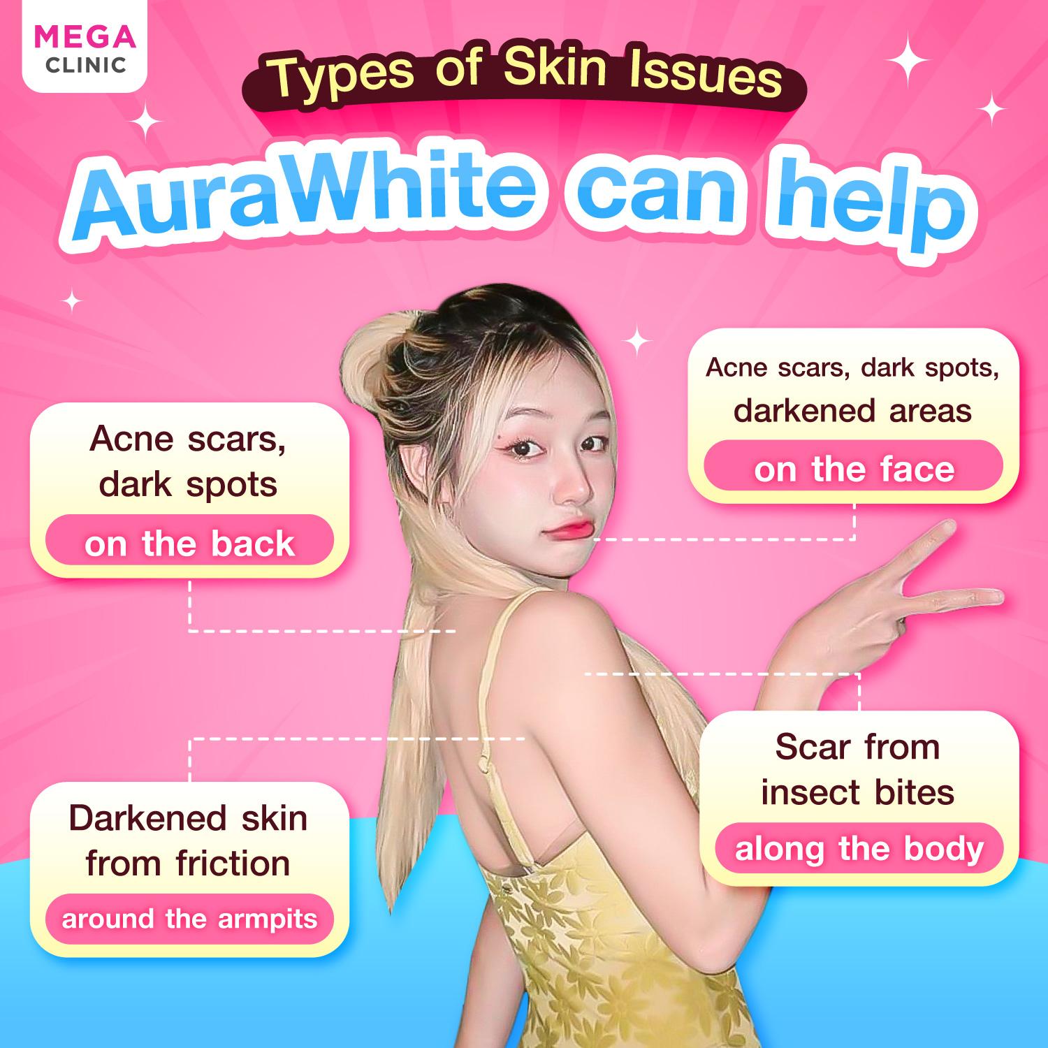 ปัญหาผิวแบบไหนควรฉีดAura white