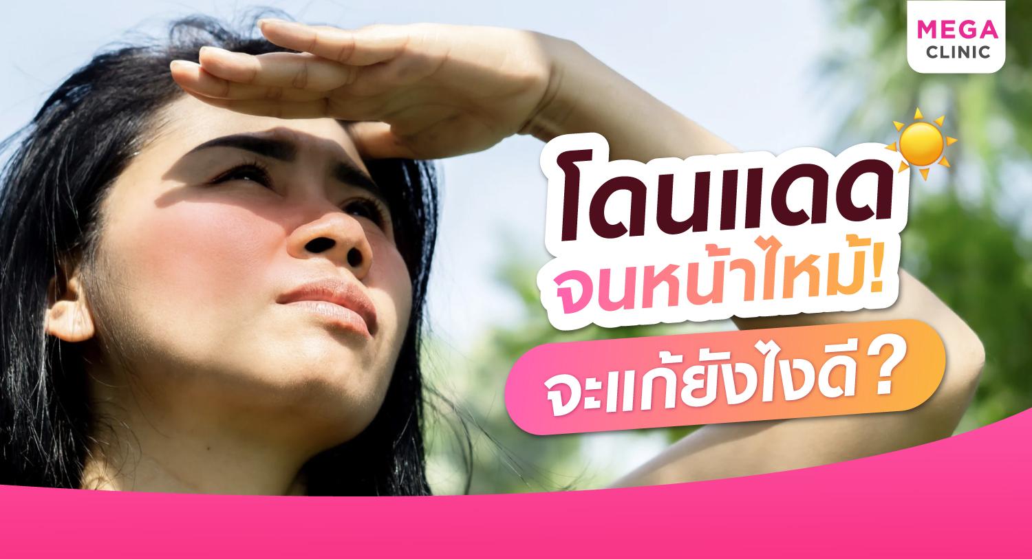 หน้าไหม้แดด ผิวหน้าโดดแดดบ่อย ดูแลยังไง?