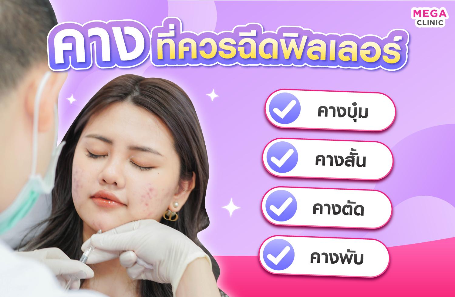 ฟิลเลอร์คางเหมาะกับใคร