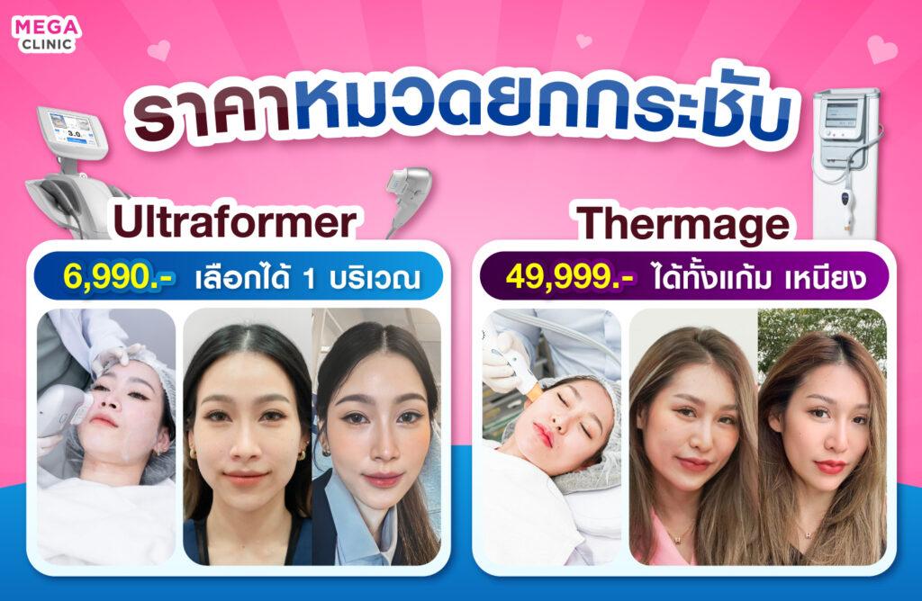 ราคาUltraformer ราคาThermage