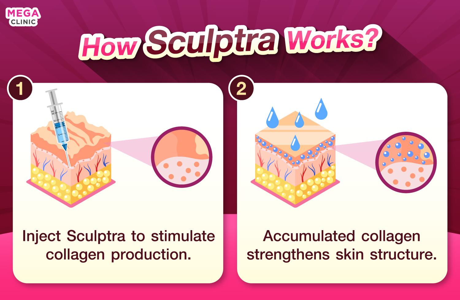 กระบวนการทำงาน Sculptra