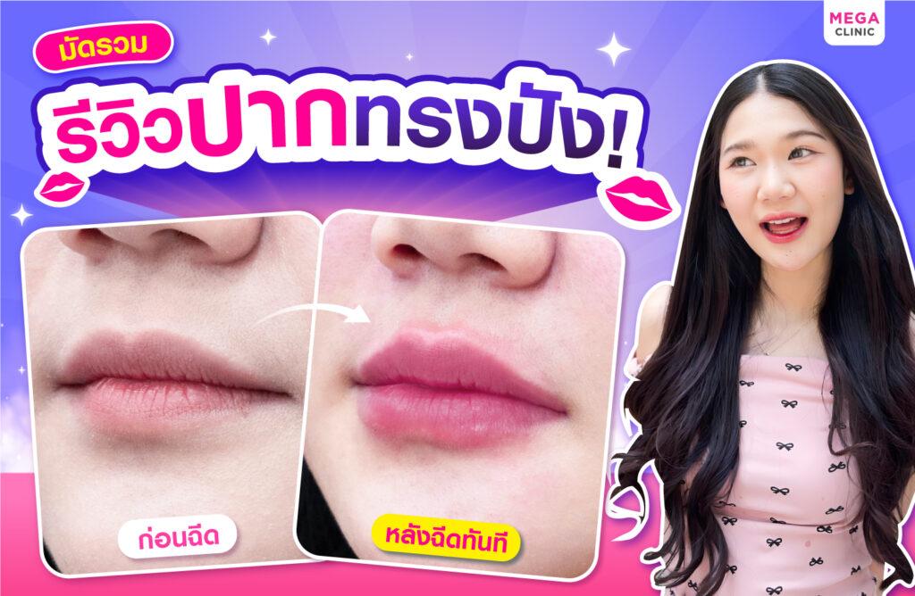 รีวิวฉีดฟิลเลอร์ปาก น้องพิซซ่า