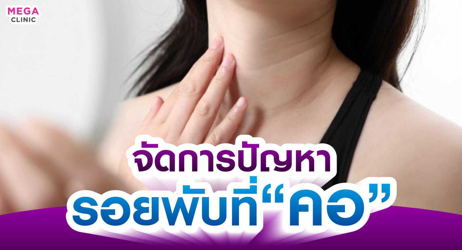 รอยพับที่คอ คอเป็นเส้น เกิดจากอะไร แก้ยังไงให้กลับมาเรียบเนียน