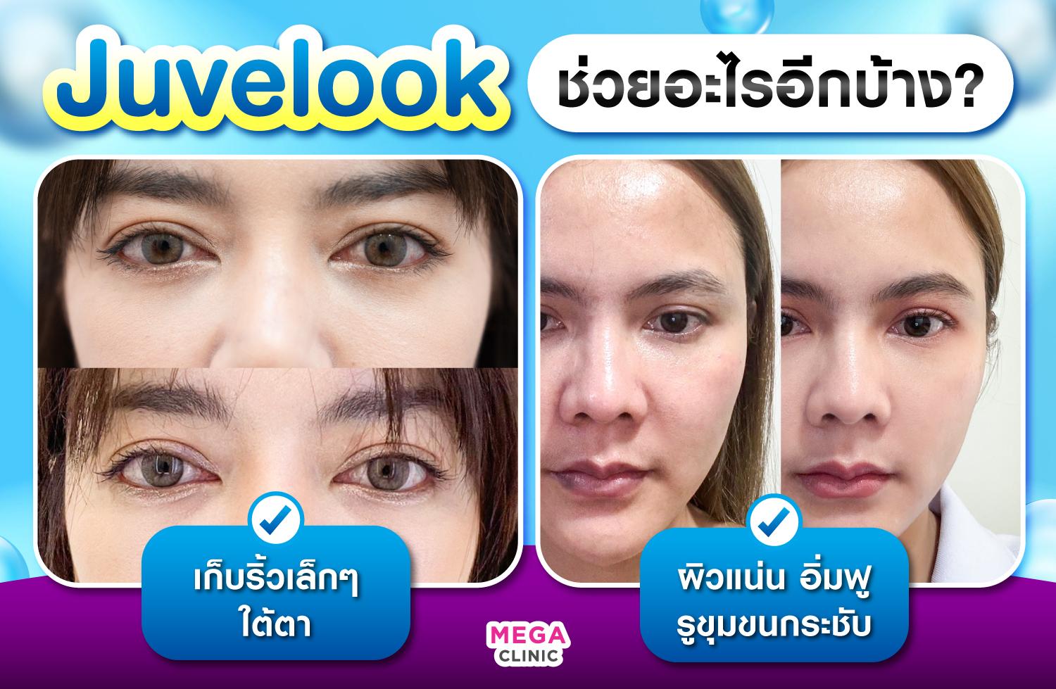 รวมรีวิว Juvelook ทั้งหมด