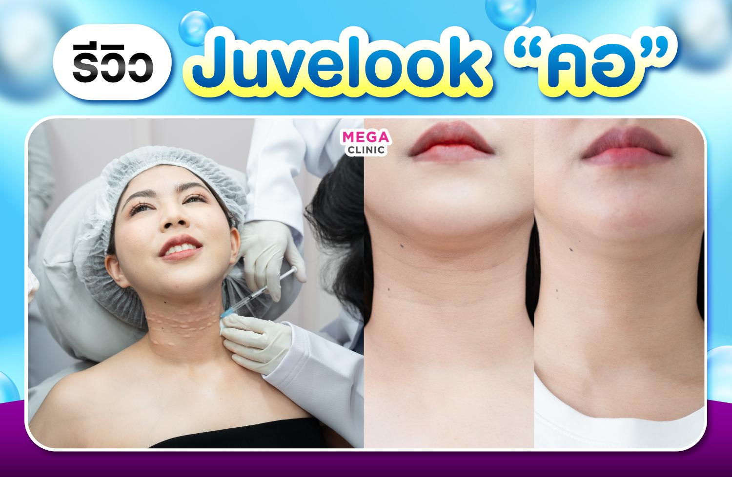 รีวิว juvelook รอยพับที่คอ