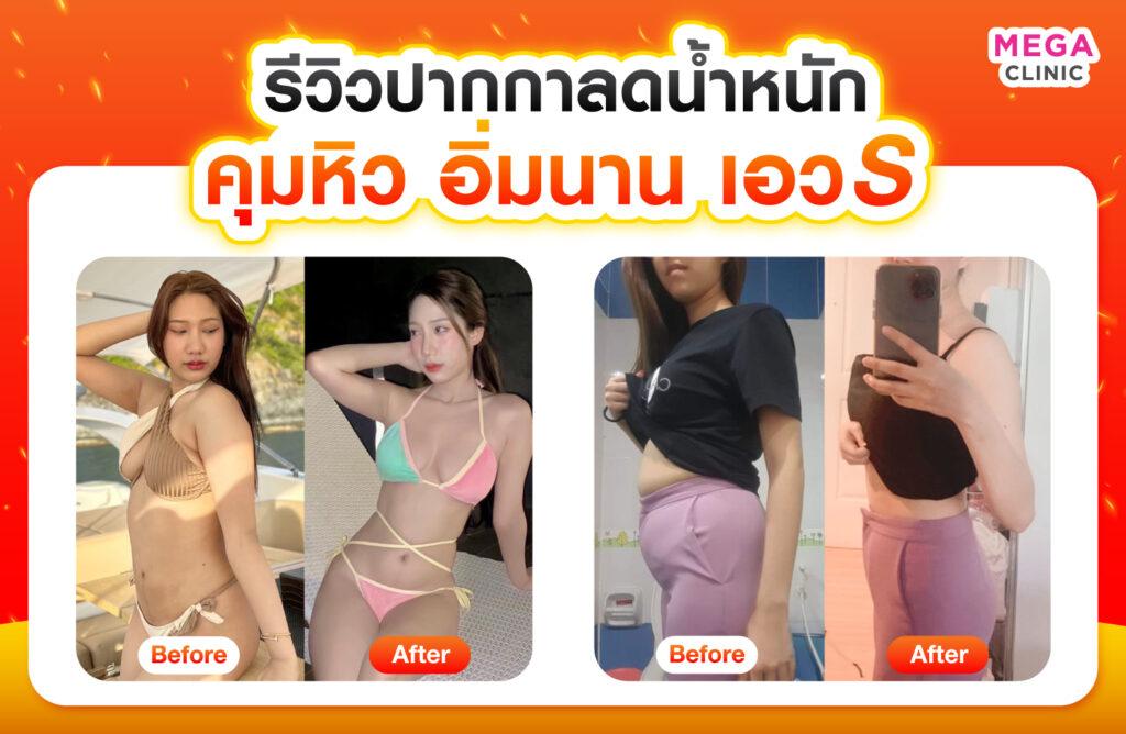 รีวิวปากกาลดน้ำหนัก