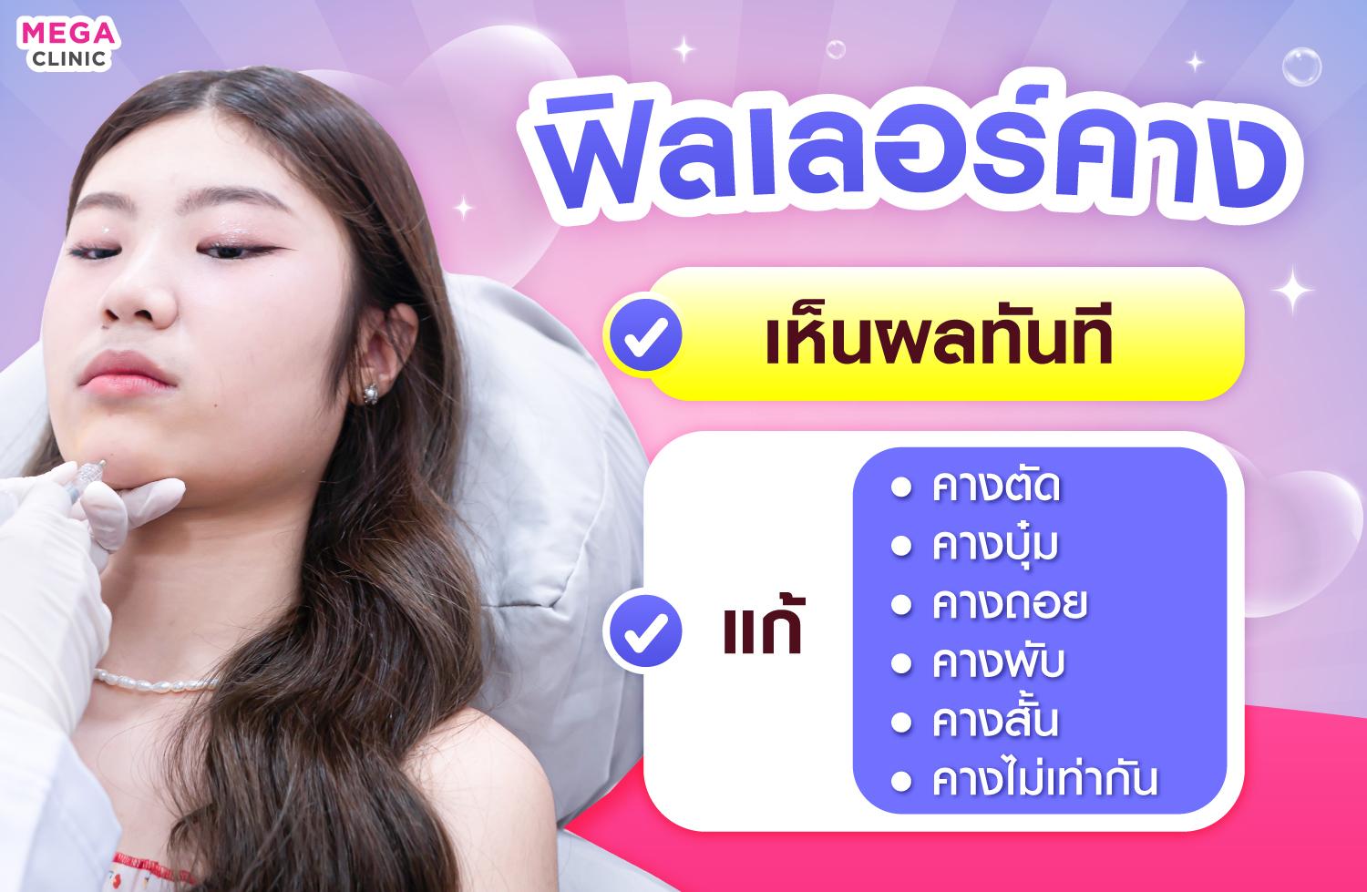 ฟิลเลอร์คาง