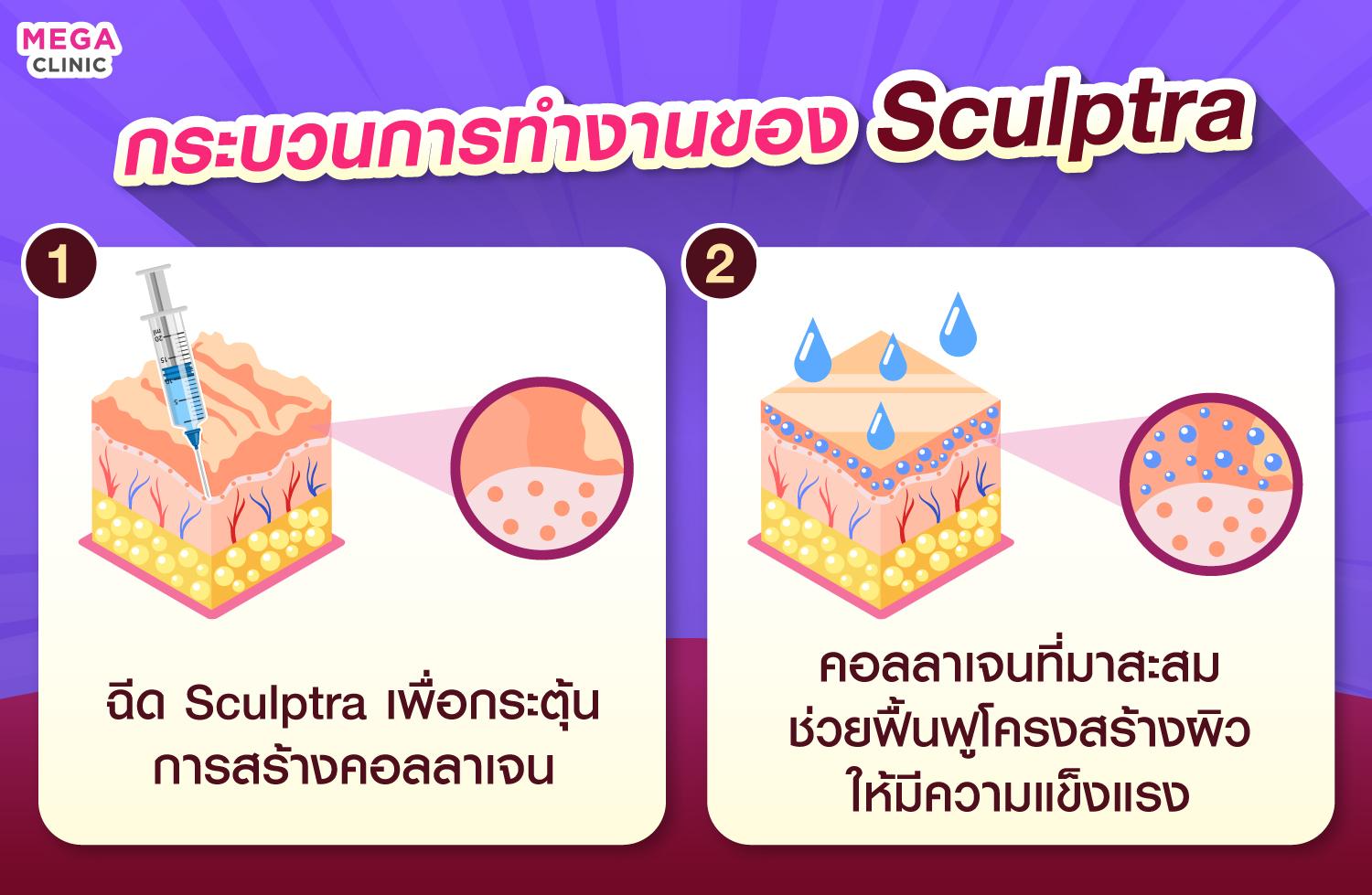 ส่วนประกอบหลักและคุณสมบัติใน Sculptra