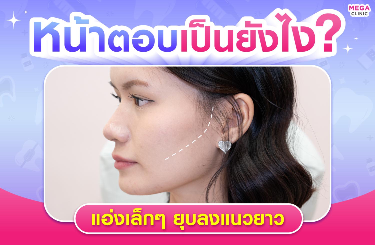 ลักษณะหน้าตอบ