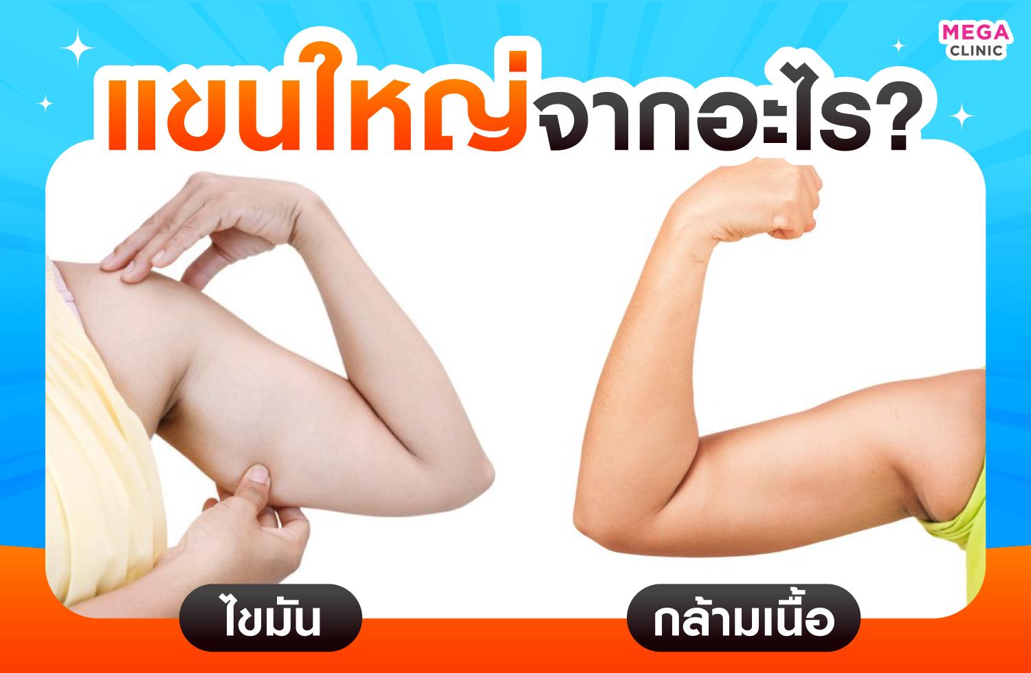 แขนใหญ่จากไขมัน และแขนใหญ่จากกล้ามเนื้อ