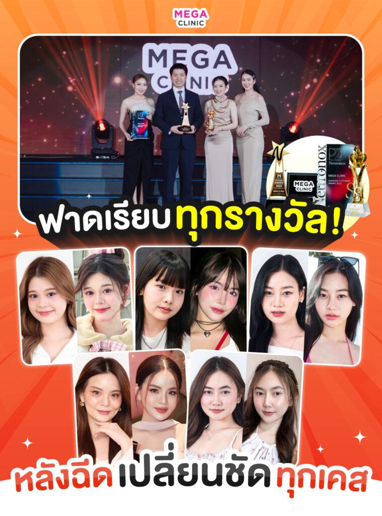 รับรางวัล & รวมรีวิวหน้าเรียว เมกะ คลินิก