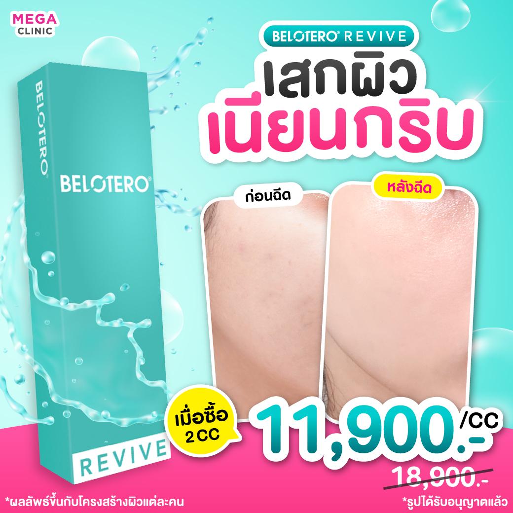 ราคาฟิลเลอร์ Belotero revive