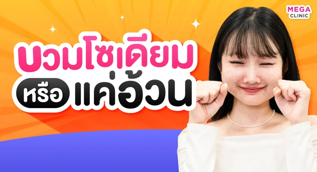 หน้าบวมเกิดจากอะไร หน้าบวมโซเดียมหรือแค่อ้วน