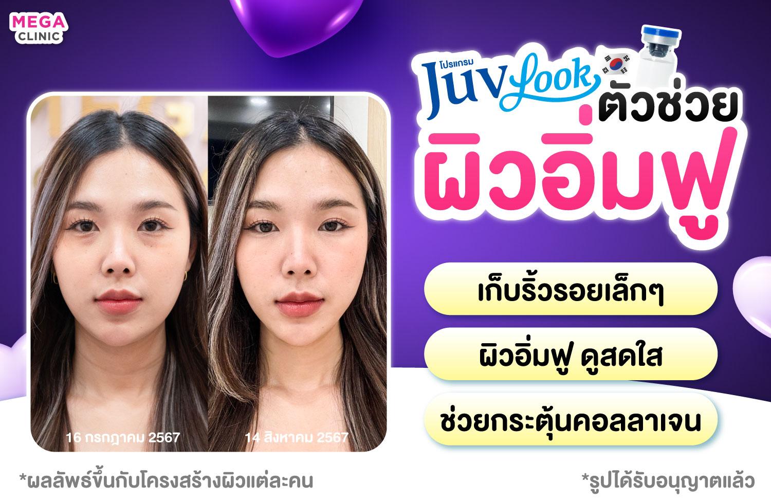 รีวิว Juvelook ช่วยเรื่องอะไร พร้อมรีวิว