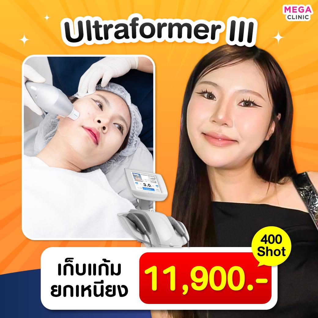 ขณะทำ Ultraformer III