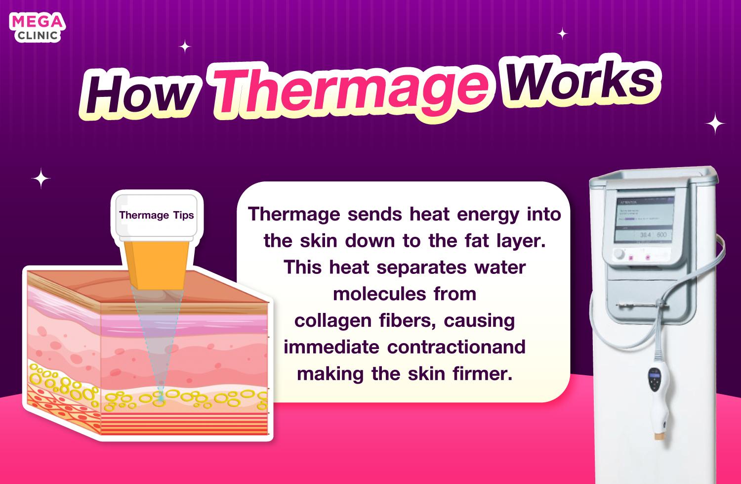 การทำงานของ Thermage