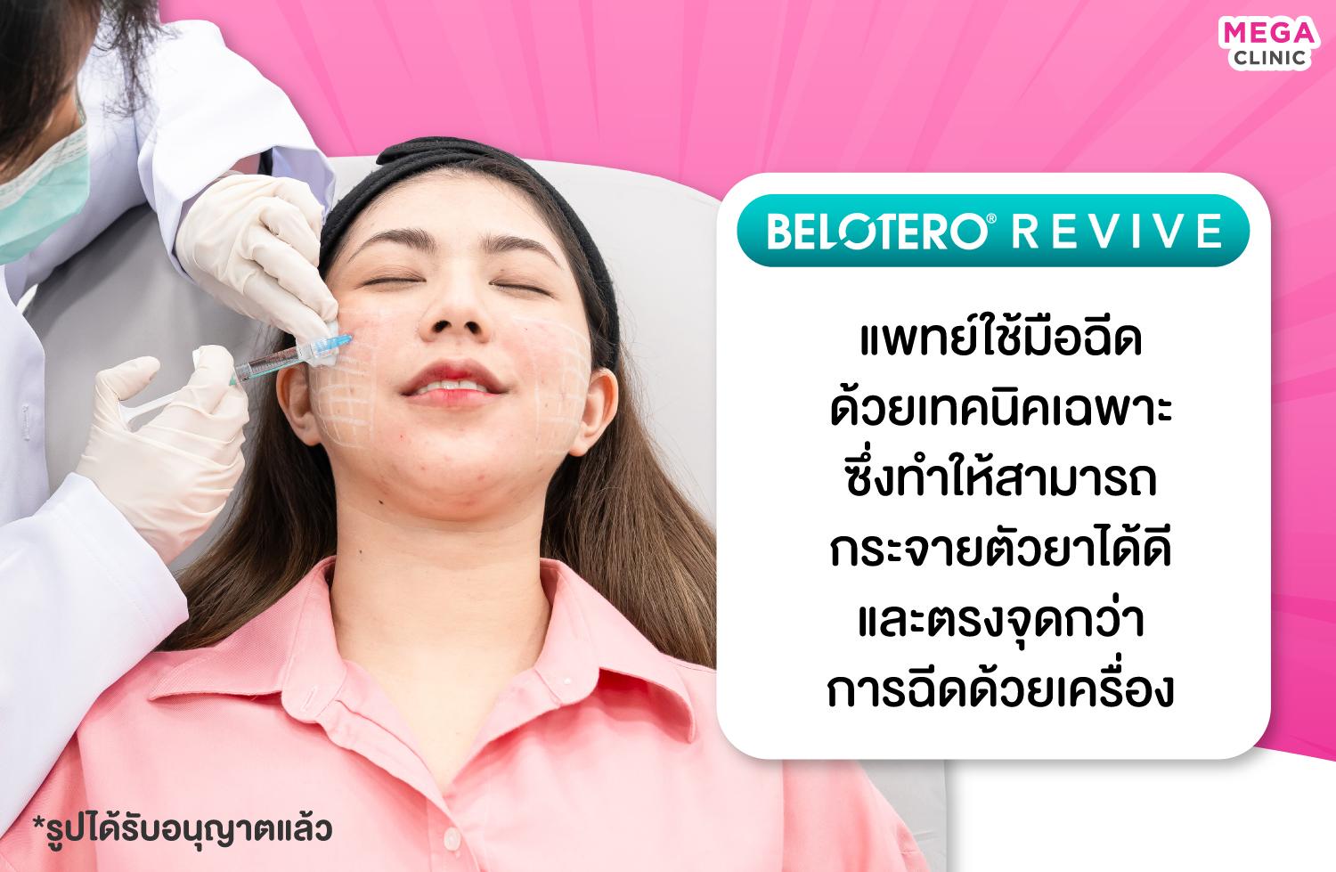 แพทย์ใช้มือฉีด Belotero Revive