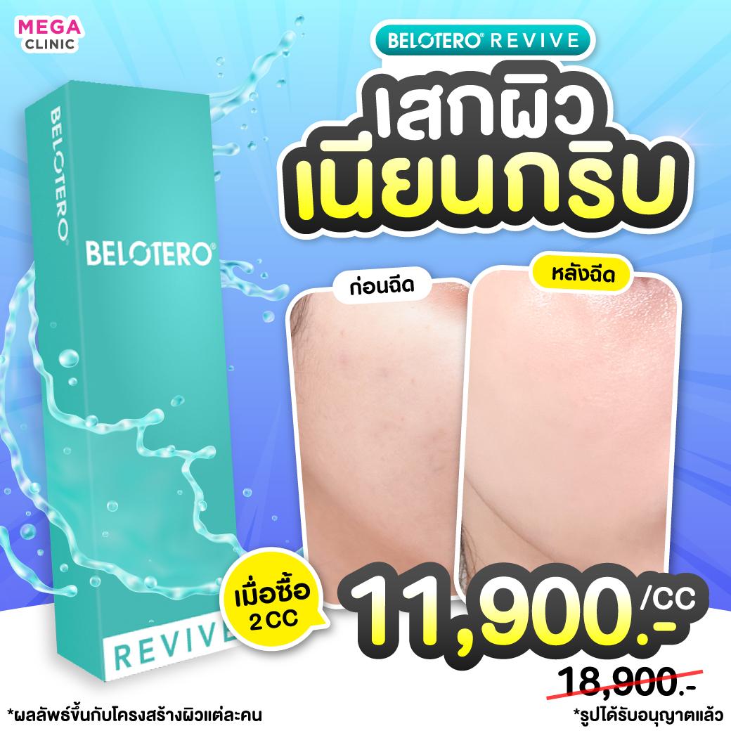 ราคาReviveและรีวิว