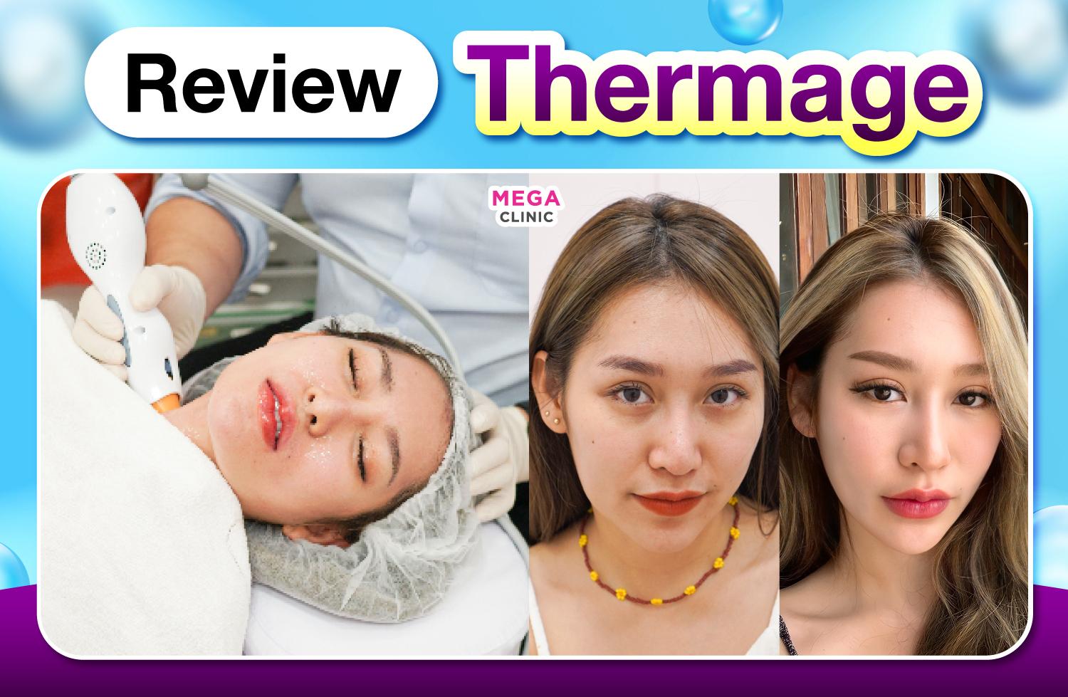 รีวิว thermage