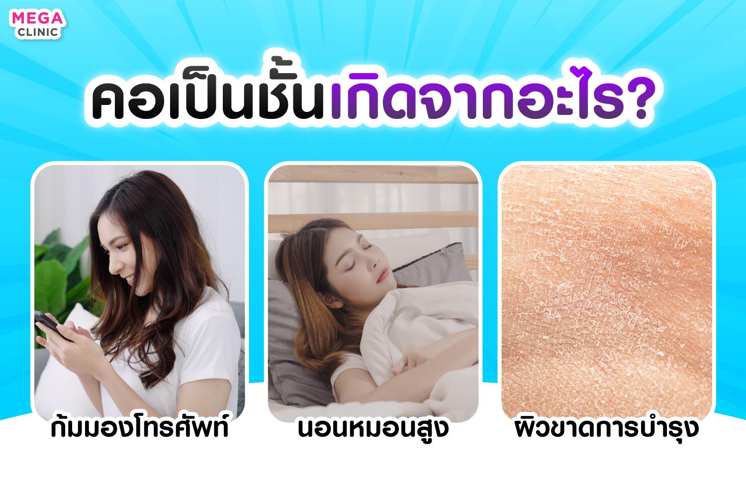 คอเป็นชั้นเกิดจากอะไร สาเหตุคอเป็นชั้น