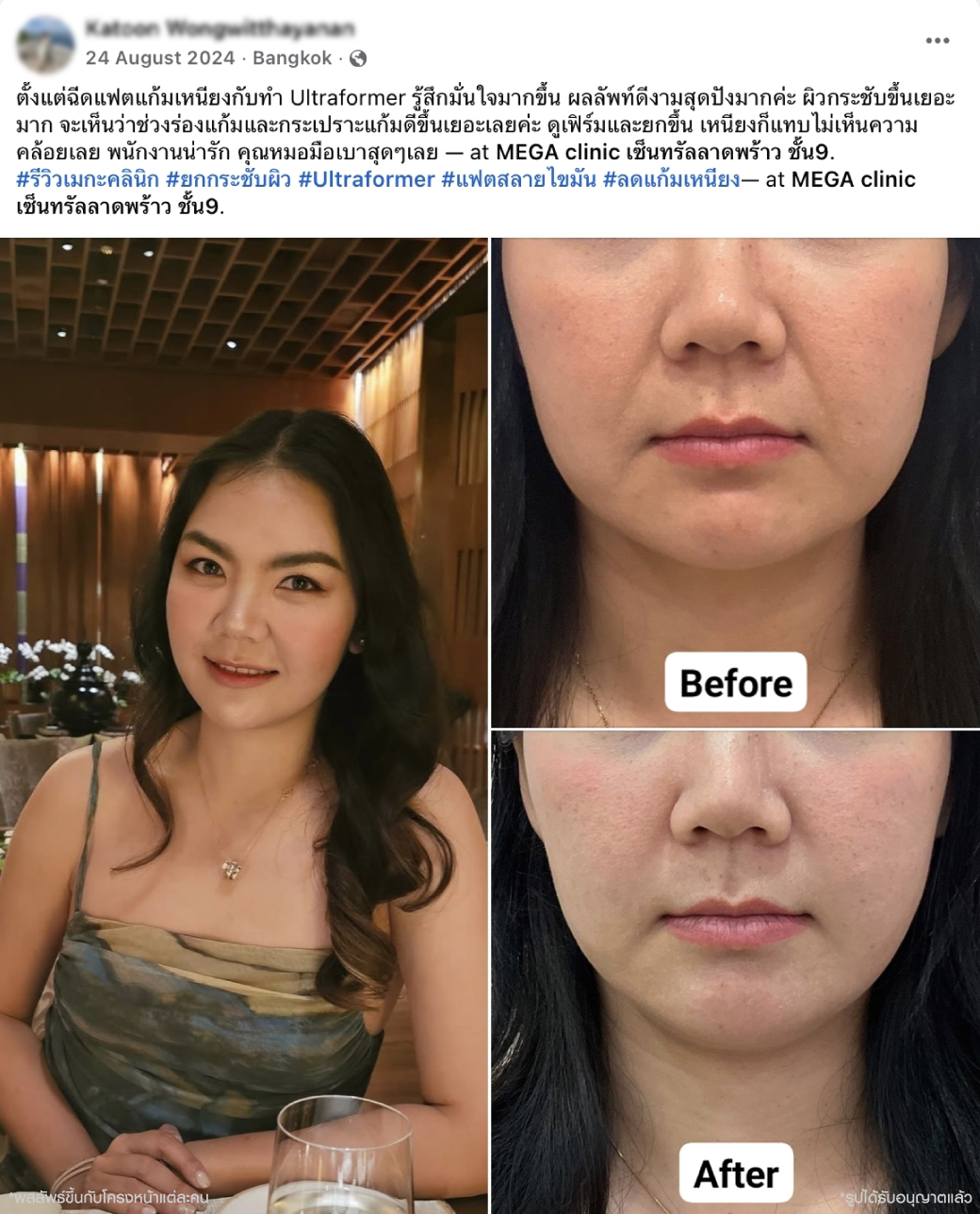 รีวิวลูกค้า MEGA CLINIC