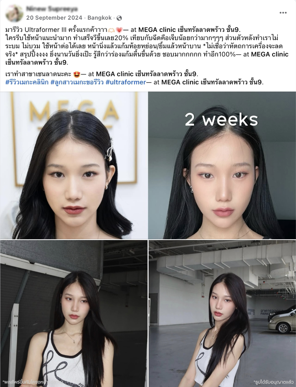 รีวิวลูกค้า MEGA CLINIC