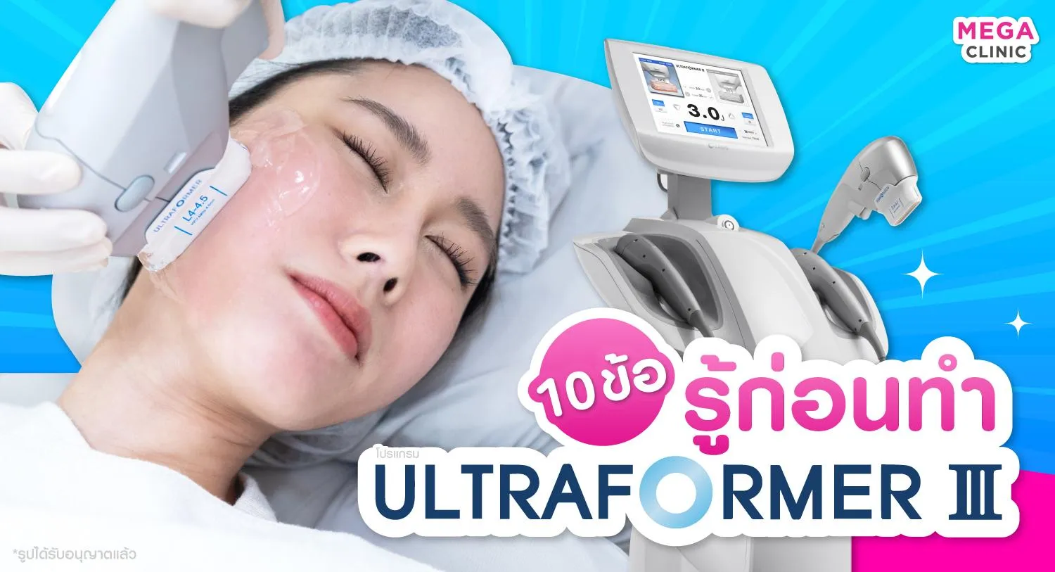 Ultraformer III ดีไหม ข้อดี ข้อเสียมีอะไรบ้าง