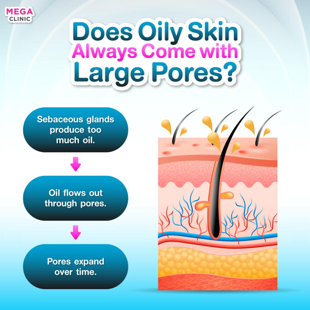 How to Get Rid of Oily Skin: Causes & Routines - SHISEIDO