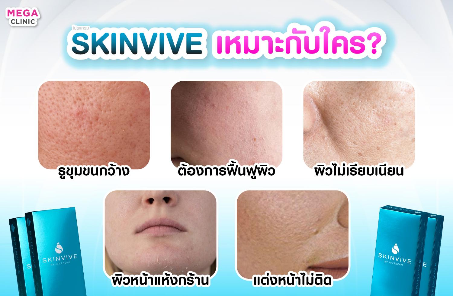 Skinvive เหมาะกับใคร