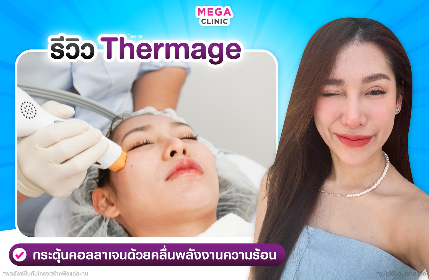 Thermage ยกกระชับ สลายไขมัน กระตุ้นคอลลาเจน