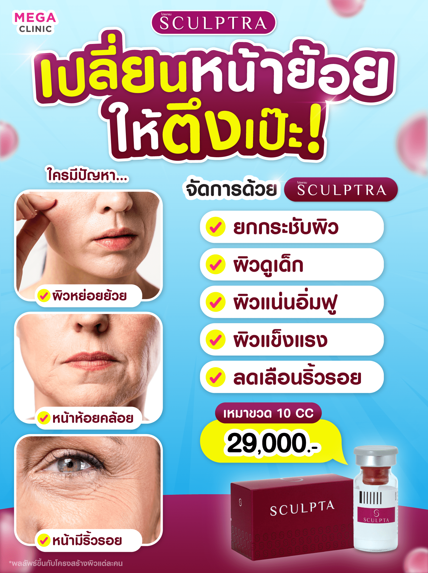 สรรพคุณ+ราคา Sculptra