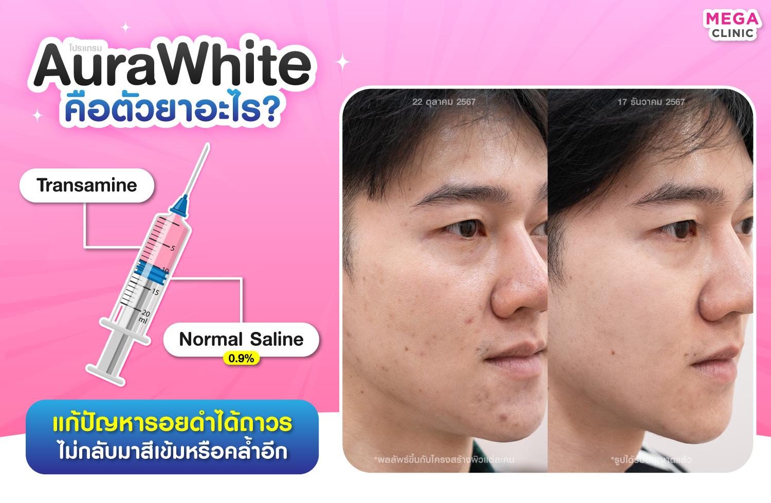 AuraWhite คือตัวยาอะไร?