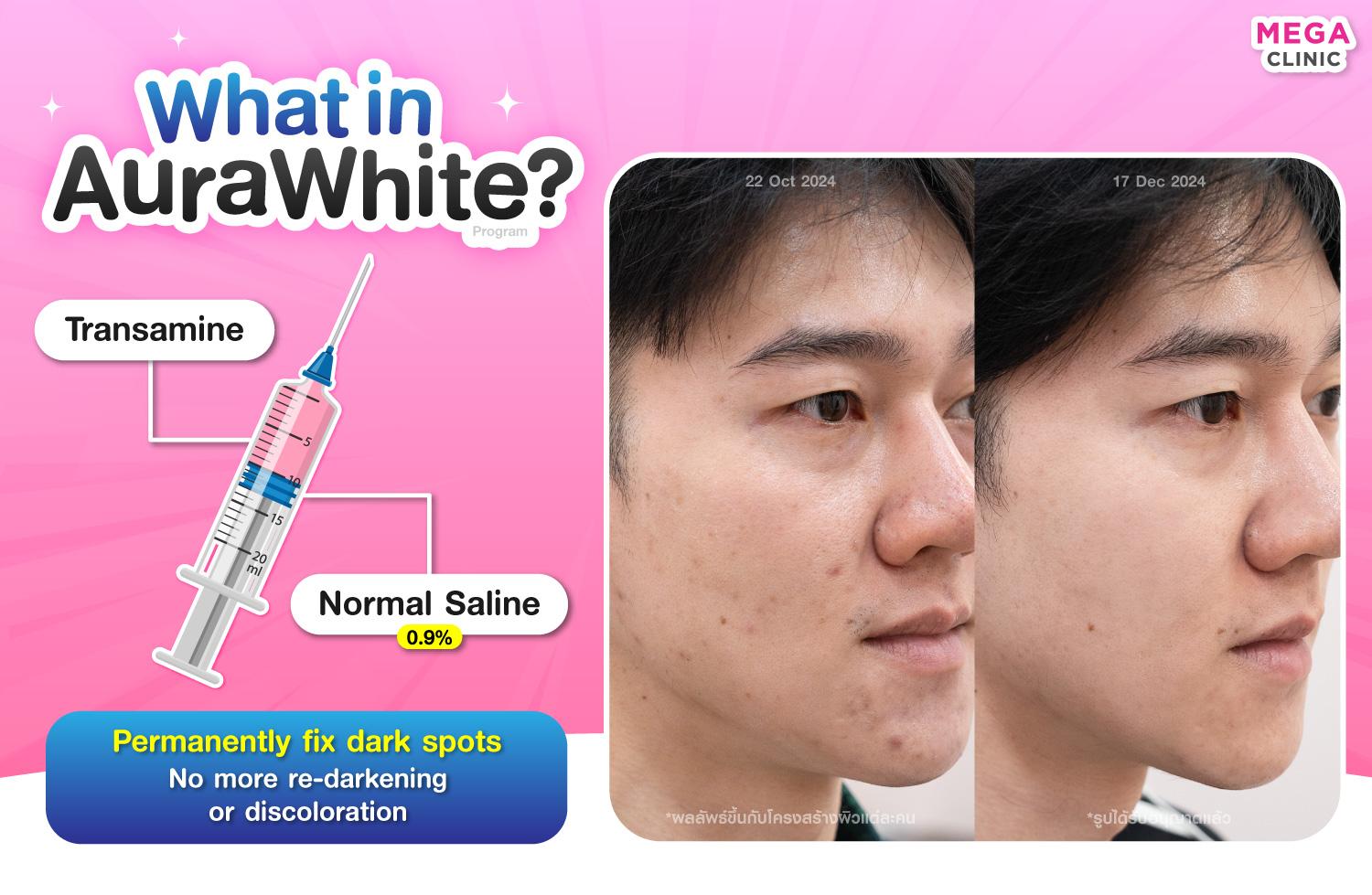 AuraWhite คือตัวยาอะไร?