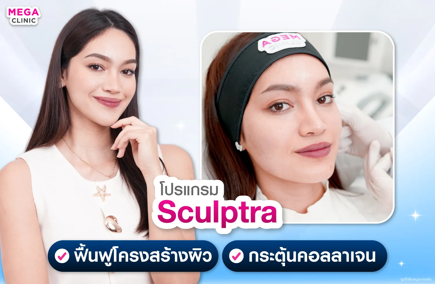 Sculptra กระตุ้นคอลลาเจน ฟื้นฟูโครงสร้างชั้นลึกของผิว