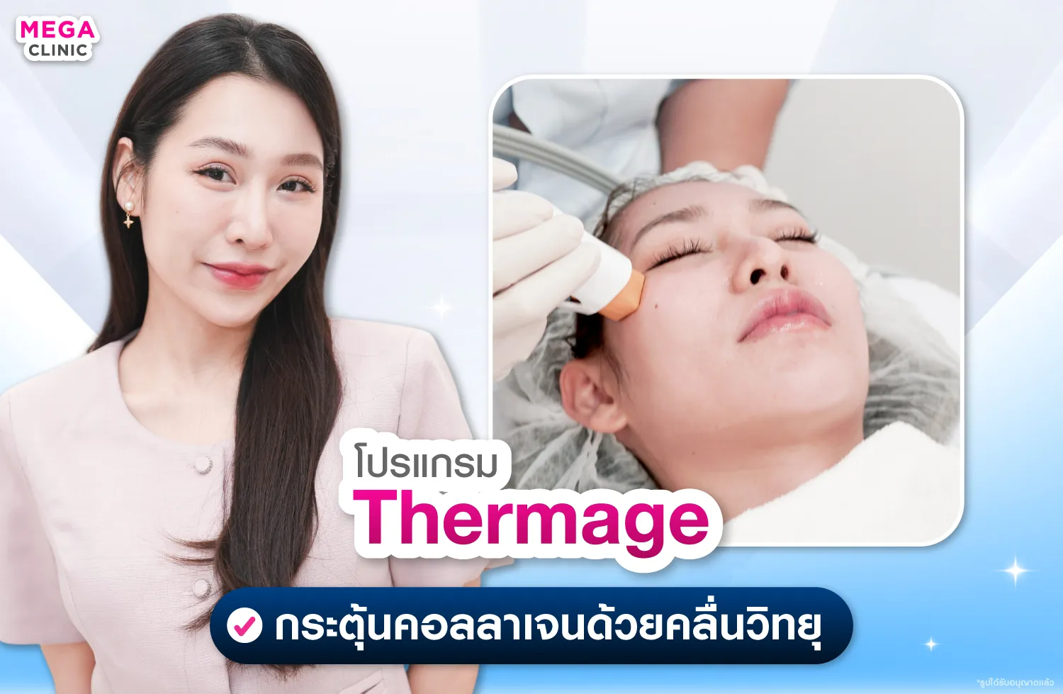 Thermage ยกกระชับ สลายไขมัน พร้อมกระตุ้นคอลลาเจน