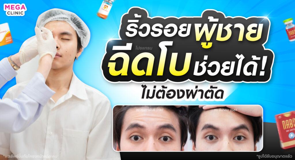 โบลดริ้วรอย ริ้วรอยผู้ชาย