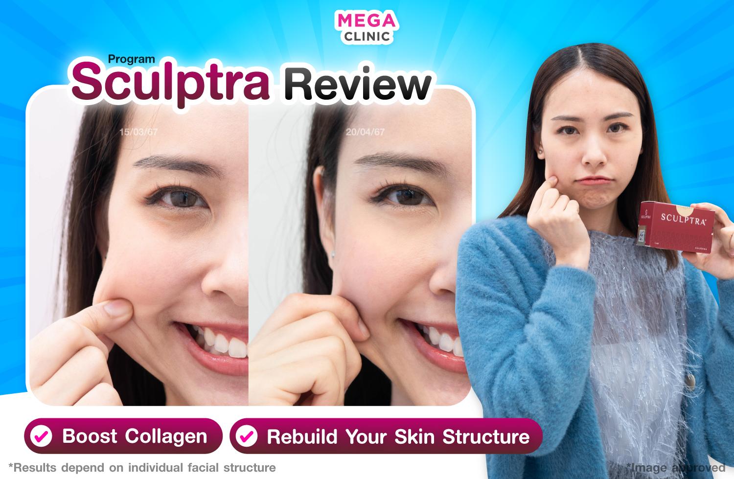 Sculptra กระตุ้นคอลลาเจน ฟื้นฟูโครงสร้างผิว